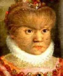 Амруазская семья. 1583. Проявление гирсутизма.
 Дочь. Как видим волосатость лица не слишком портит ее внешность